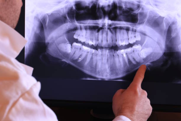 Best Emergency Treatment for Jaw Pain or Injury in Smithsburg, MD
