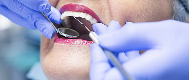Best Emergency Wisdom Tooth Extraction in Smithsburg, MD